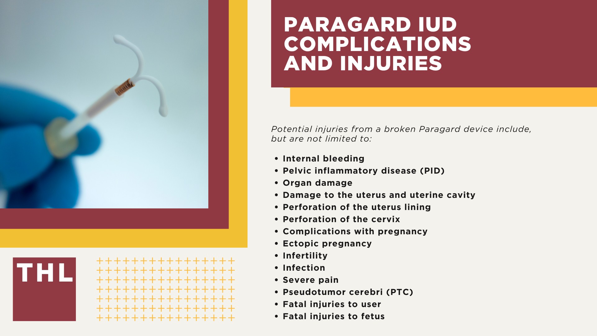 What is the Paragard IUD Lawsuit; Why Are Women Suing Over Paragard IUD Injuries; Paragard IUD Lawsuit Settlement Amounts_ Projections & Estimates; How Paragard Settlements Might Be Structured; What is the Paragard Intrauterine Device (IUD); Paragard IUD Complications and Injuries