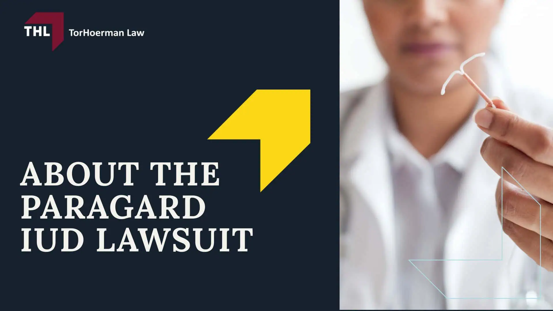 Paragard Migration Injury Lawsuit - About The Paragard Intrauterine Device (IUD) - torhoerman law; Paragard Migration Injury Lawsuit - Understanding Paragard IUD Migration - torhoerman law; Paragard Migration Injury Lawsuit - The Dangers of Paragard IUD Migration - torhoerman law; Paragard Migration Injury Lawsuit - Treatment Options for Paragard IUD Migration - torhoerman law; Paragard Migration Injury Lawsuit - About The Paragard IUD Lawsuit - torhoerman law