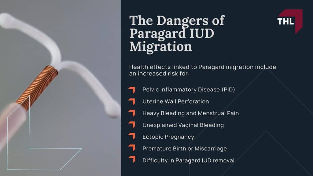 Migration Risk Iud Paragard Migration Injury Lawsuit | #1 Attorneys For Paragard IUD Lawsuits