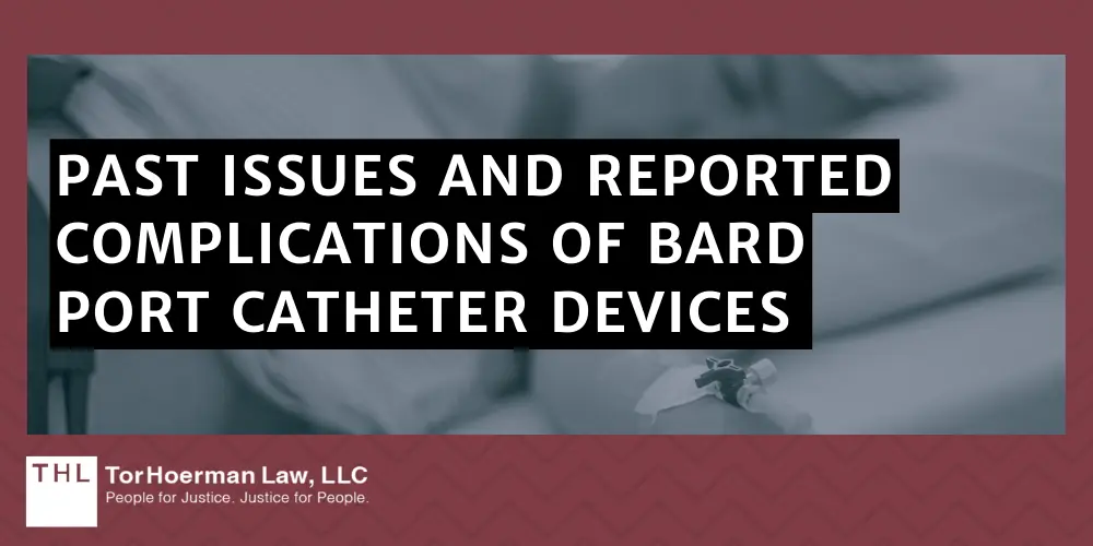 Past Issues And Reported Complications Of Bard Port Catheter Devices