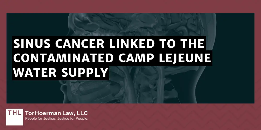 Sinus Cancer Linked To The Contaminated Camp Lejeune Water Supply