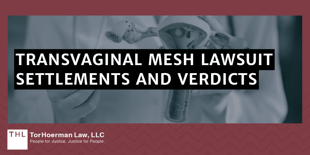 Transvaginal Mesh Lawsuit Settlements And Verdicts