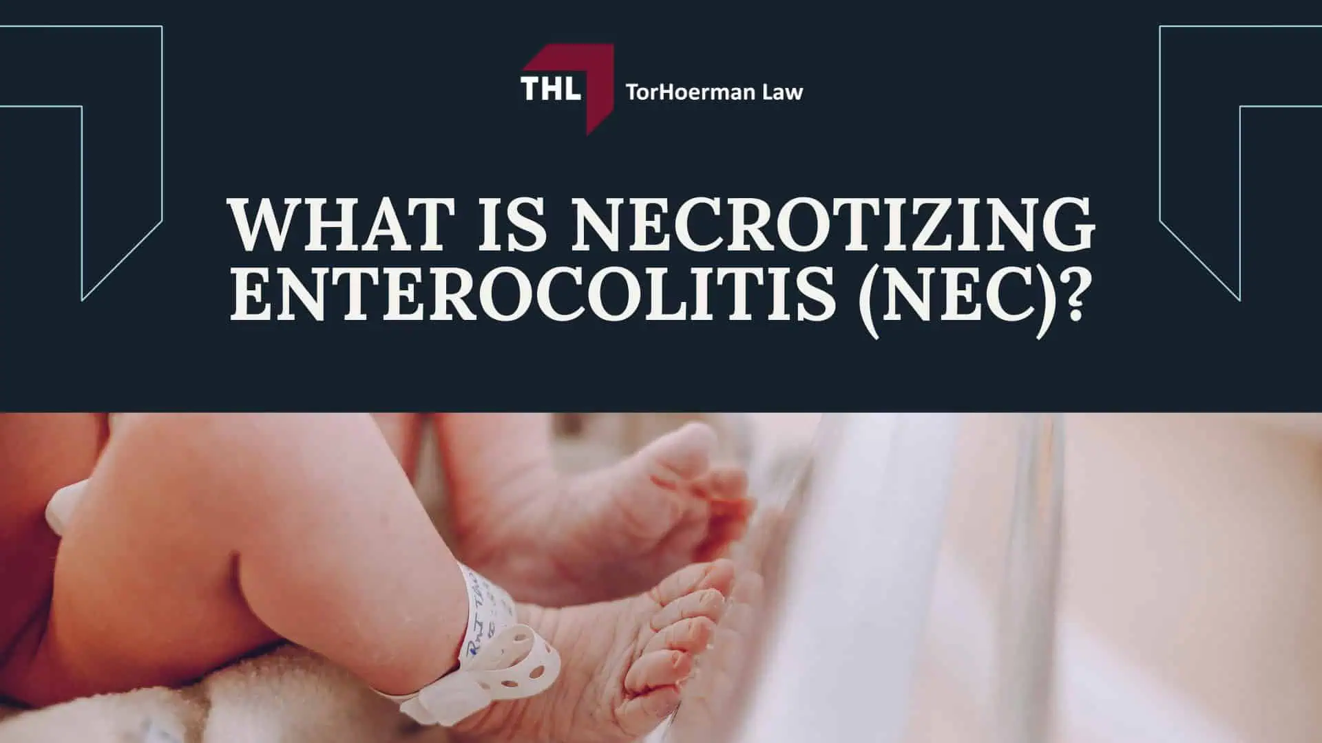 OVERVIEW OF THE NEC BABY FORMULA LAWSUITS - TOXIC BABY FORMULA NEC LAWSUITS - TORHOERMAN LAW; WHAT IS THE NEC INFANT FORMULA MDL_ - TOXIC BABY FORMULA NEC LAWSUITS - TORHOERMAN LAW; WHAT BABY FORMULA BRANDS ARE INVLUDED IN NEC LAWSUITS_ -TOXIC BABY FORMULA NEC LAWSUITS - TORHOERMAN LAW; TORHOERMAN LAW OBTAINS MILLION VERDICT IN NEC LAWSUIT TRIAL - TOXIC BABY FORMULA NEC LAWSUIT - 2026 DESIGN - TORHOERMAN LAW; MEET YOUR TEAM OF BABY INJURY LAWYERS - TOXIC BABY FORMULA NEC LAWSUITS - TORHOERMAN LAW; ABOUT NECROTIZING ENTEROCOLITIS (NEC) - TOXIC BABY FORMULA NEC LAWSUITS - TORHOERMAN LAW; SYMPTOMS OF NEC - TOXIC BABY FORMULA NEC LAWSUITS - TORHOERMAN LAW; WHAT IS NECROTIZING ENTEROCOLITIS_ - TOXIC BABY FORMULA NEC LAWSUITS - TORHOERMAN LAW