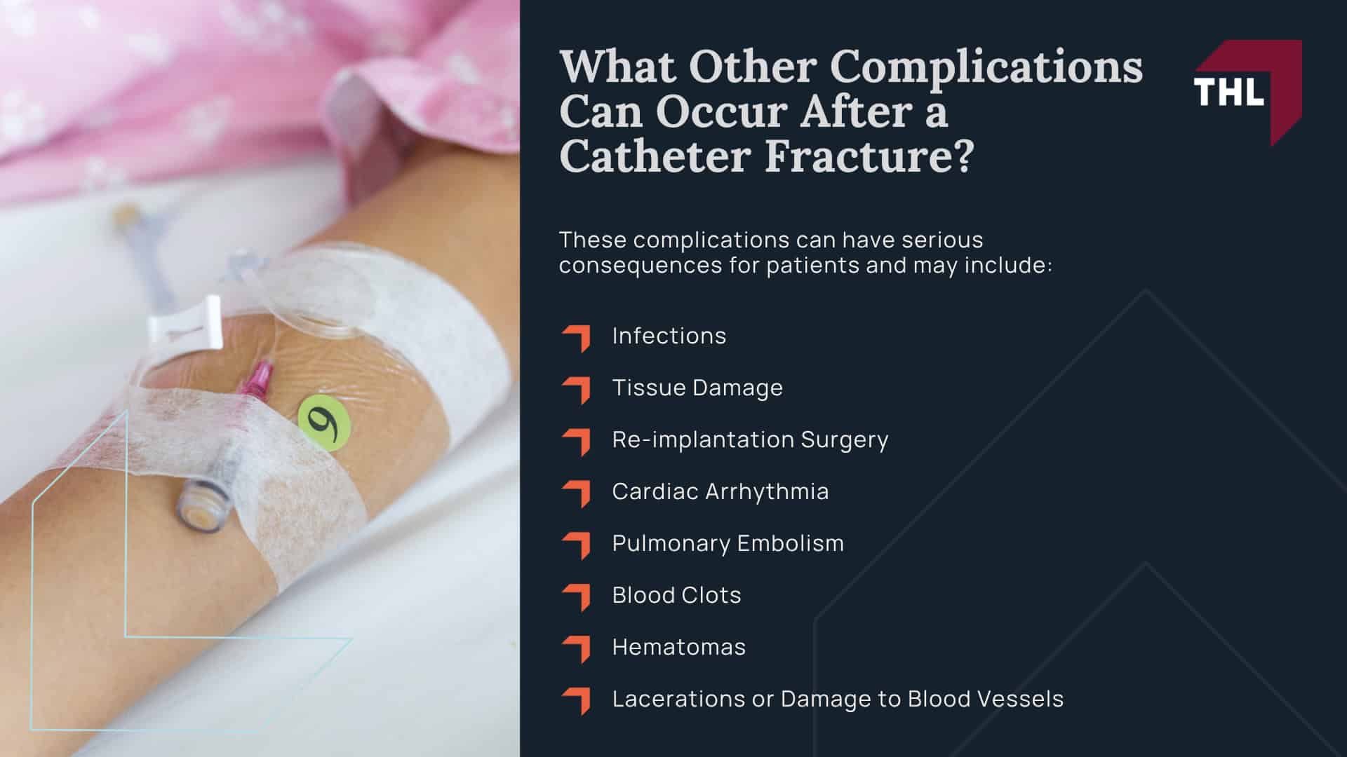 What You Need To Know About the Bard PowerPort Device; What Is the Bard PowerPort Used For; Who Uses the Bard PowerPort Device; Bard PowerPort Health Effects and Potential Life Threatening Complications; Bard PowerPort Catheter Fracture Lawsuit - What Is a Catheter Fracture_ - torhoerman law; What Are the Signs of Catheter Fracture; Why Does Catheter Fracture Occur on Bard PowerPort Devices; What Other Complications Can Occur After a Catheter Fracture