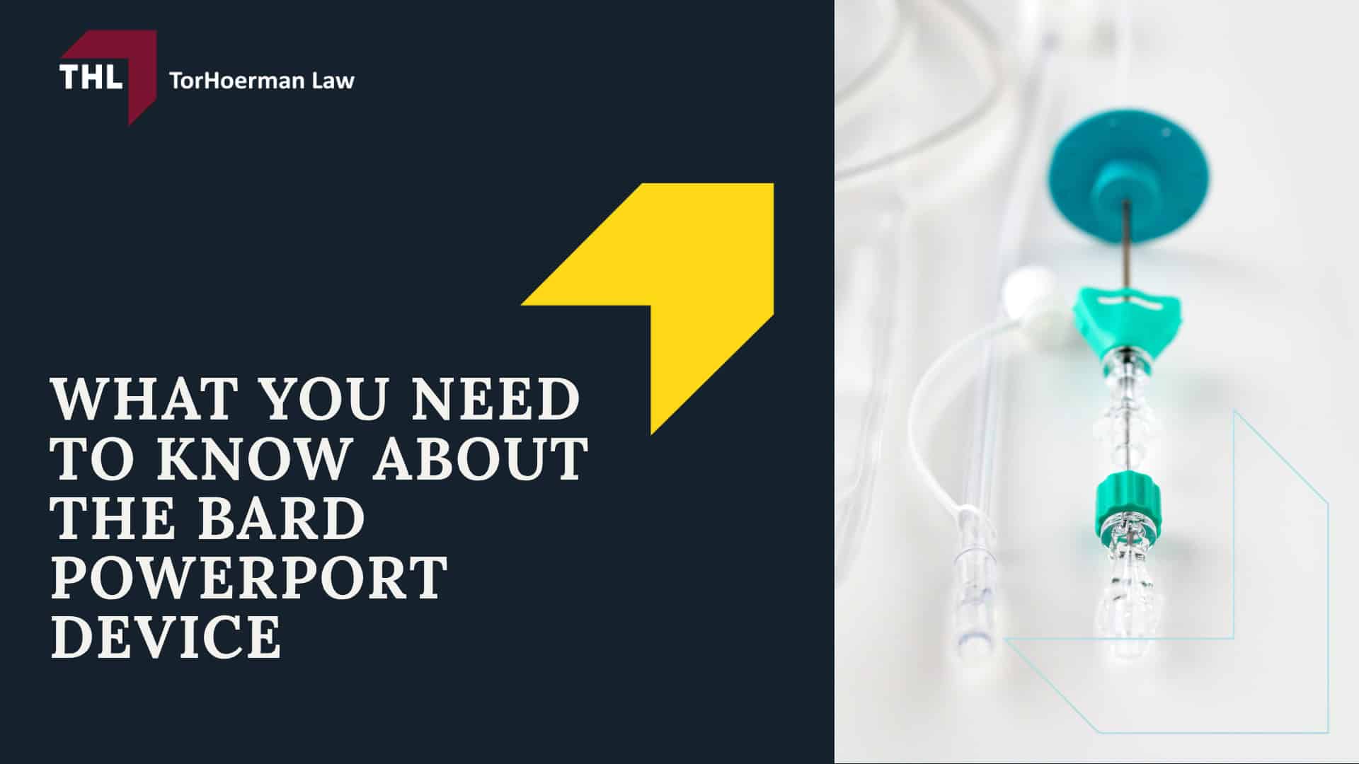 What You Need To Know About the Bard PowerPort Device
