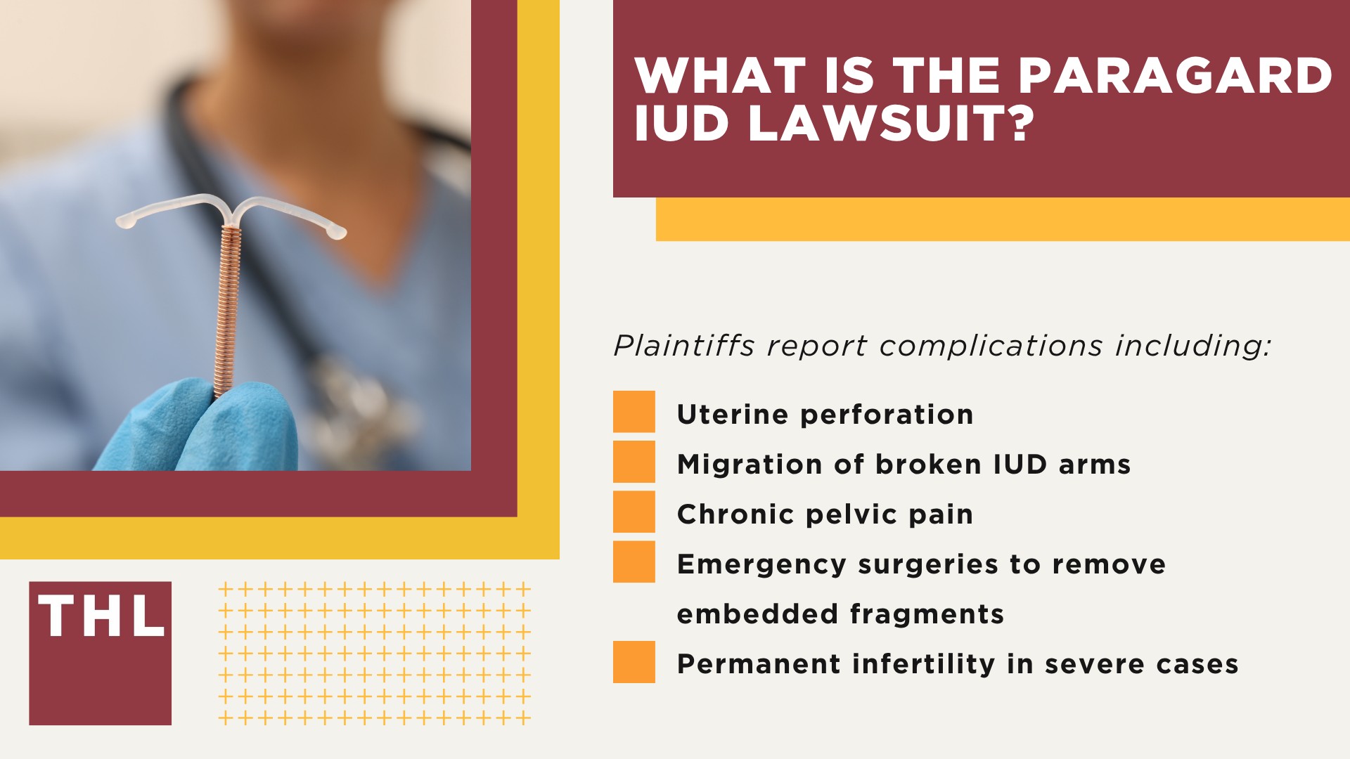 What is the Paragard IUD Lawsuit