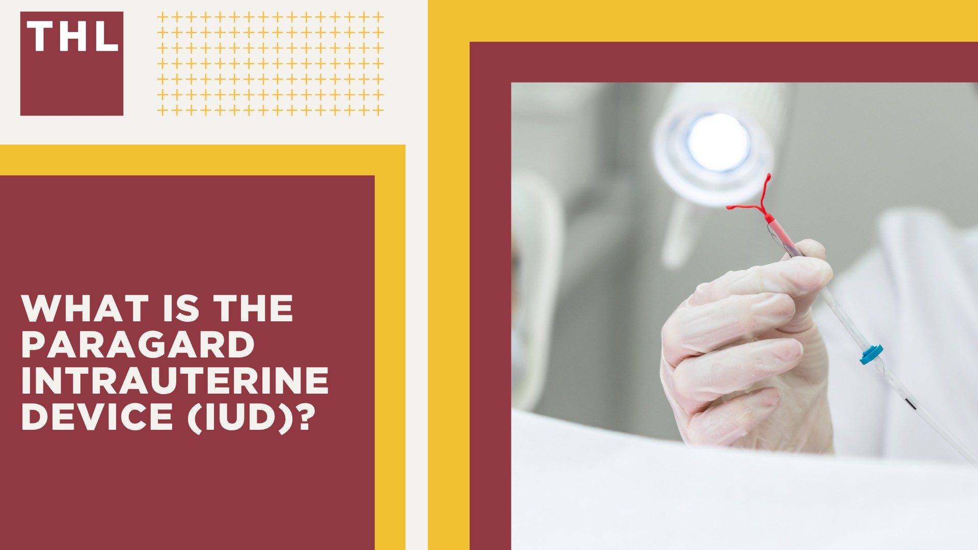 What is the Paragard IUD Lawsuit; Why Are Women Suing Over Paragard IUD Injuries; Paragard IUD Lawsuit Settlement Amounts_ Projections & Estimates; How Paragard Settlements Might Be Structured; What is the Paragard Intrauterine Device (IUD)