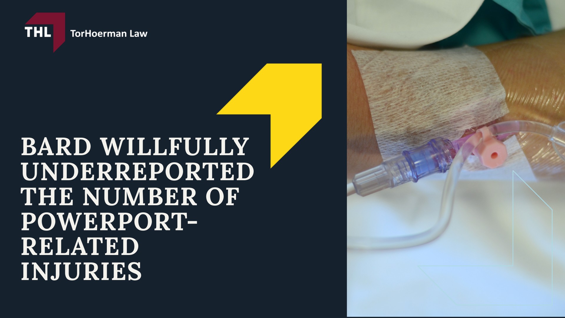 What Is the Bard PowerPort Device?; Bard PowerPort Device Malfunctions; Injuries and Adverse Health Effects From Bard PowerPort Devices; How To Report Bard PowerPort Injuries; The Importance Of Reporting Your Injuries To The FDA; Bard Willfully Underreported the Number of PowerPort-Related Injuries