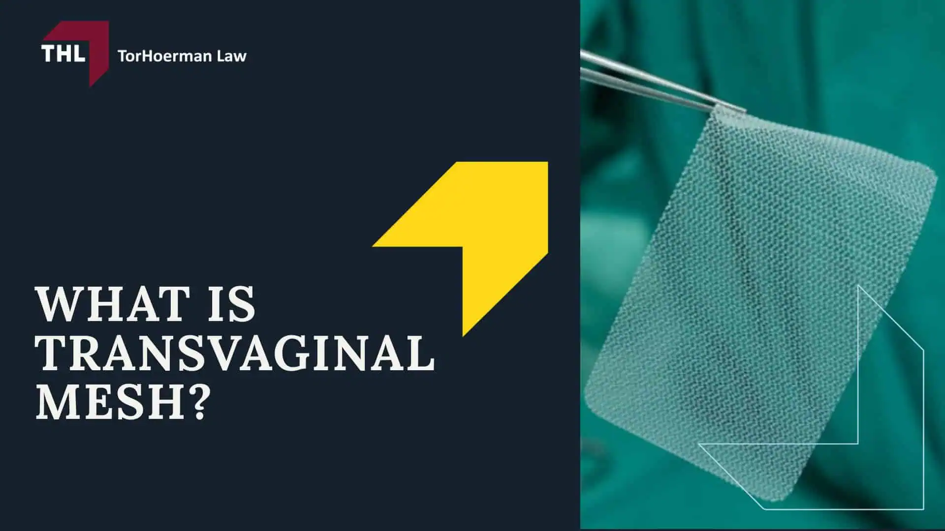 #1 Vaginal Mesh Lawyers for Transvaginal Mesh Injuries - What Is Transvaginal Mesh