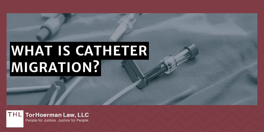 Port a Catheter Migration Symptoms; Bard PowerPort Lawsuit; Bard PowerPort Lawsuits; Port Catheter Lawsuit; What Is Catheter Migration; What causes catheter migration; Dangers of Catheter Migration