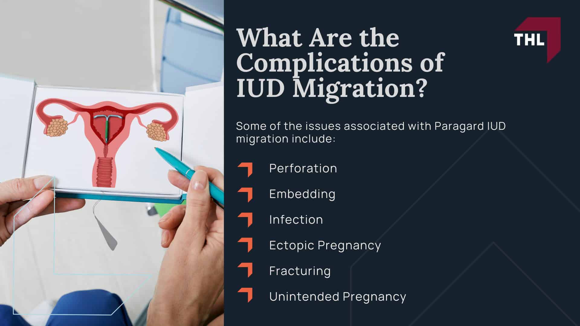 FAQ What Is the Surgical Treatment for IUD Migration - What Is the Paragard IUD - torhoerman law; FAQ What Is the Surgical Treatment for IUD Migration - Understanding IUD Migration - torhoerman law; FAQ What Is the Surgical Treatment for IUD Migration - What Does IUD Migration Mean - torhoerman law; FAQ What Is the Surgical Treatment for IUD Migration - What Are the Complications of IUD Migration - torhoerman law