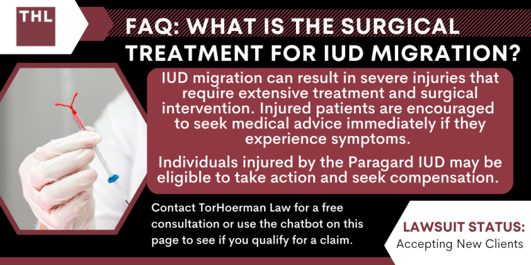 Surgical Treatment for IUD Migration; Paragard Lawsuit; Paragard IUD Lawsuit; Paragard Lawsuits; Paragard Lawyers; Paragard Migration; Paragard Fracture; Paragard MDL