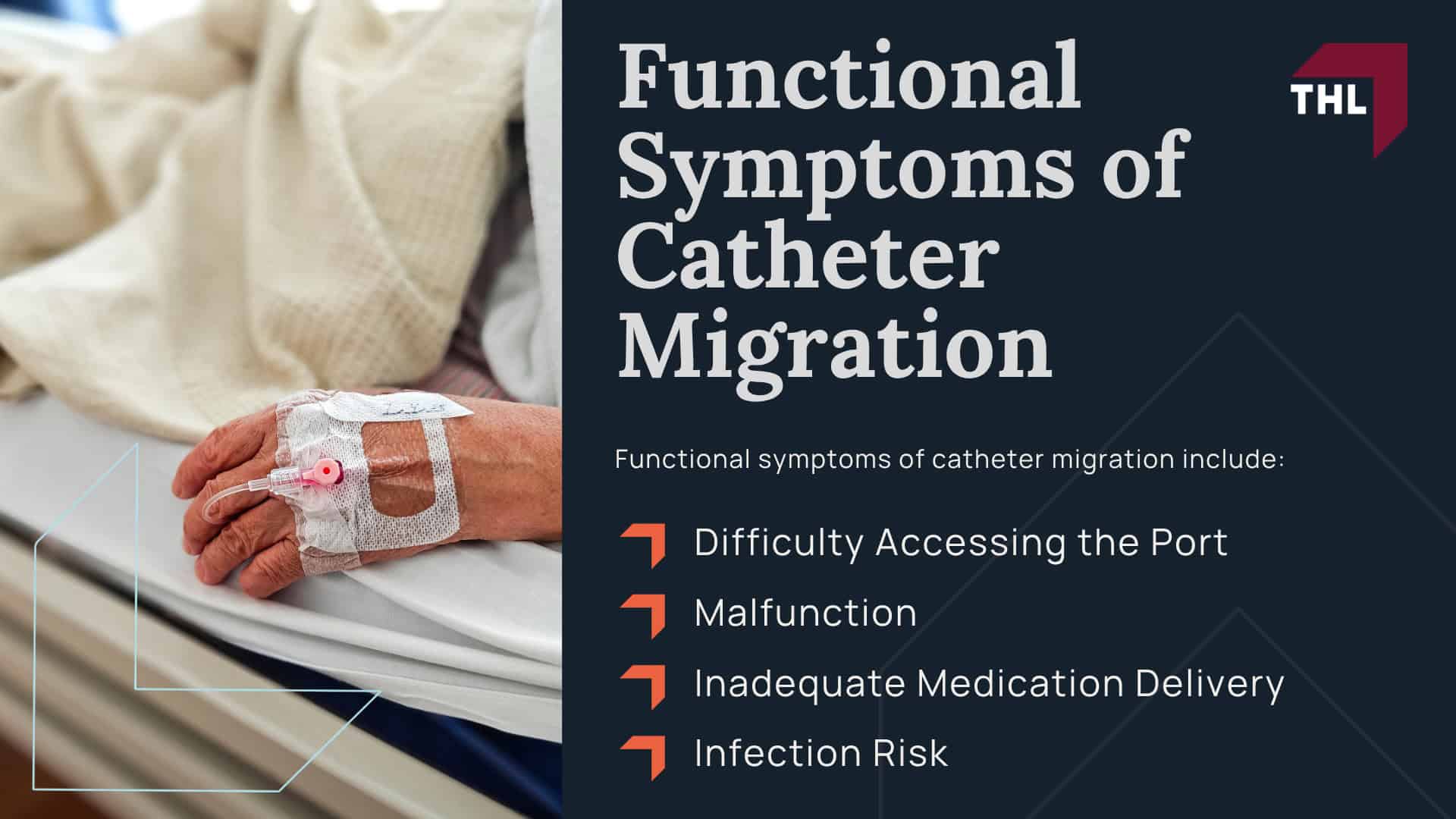 What Is Catheter Migration; The Dangers of Catheter Migration; What Causes Catheter Migration; Physical Symptoms of Port-a-Catheter Migration; What Is Catheter Migration; The Dangers of Catheter Migration; What Causes Catheter Migration; Physical Symptoms of Port-a-Catheter Migration; Functional Symptoms of Catheter Migration