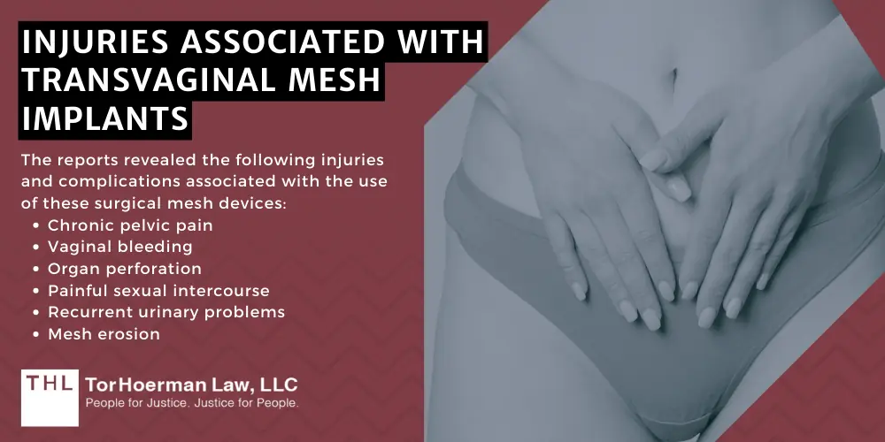 #1 Transvaginal Mesh Lawyers for Transvaginal Mesh Injuries; Transvaginal Mesh Injuries; Vaginal Mesh Lawsuit; Transvaginal Mesh Lawsuits; Transvaginal Mesh Lawyers; #1 Transvaginal Mesh Lawyers for Transvaginal Mesh Injuries; Transvaginal Mesh Injuries; Vaginal Mesh Lawsuit; Transvaginal Mesh Lawsuits; Transvaginal Mesh Lawyers; #1 Transvaginal Mesh Lawyers for Transvaginal Mesh Injuries; Transvaginal Mesh Injuries; Vaginal Mesh Lawsuit; Transvaginal Mesh Lawsuits; Transvaginal Mesh Lawyers; Injuries Associated With Transvaginal Mesh Implants