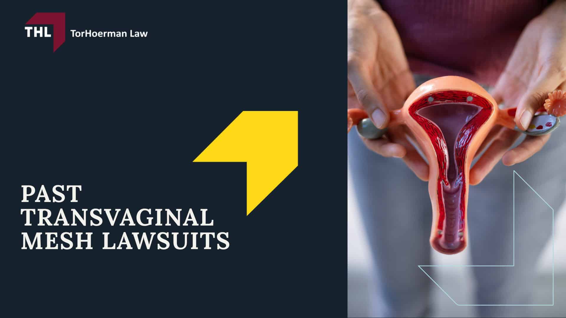 #1 Vaginal Mesh Lawyers for Transvaginal Mesh Injuries - What Is Transvaginal Mesh; #1 Vaginal Mesh Lawyers for Transvaginal Mesh Injuries - Injuries Associated With Transvaginal Mesh Implants; #1 Vaginal Mesh Lawyers for Transvaginal Mesh Injuries - What Is the Transvaginal Mesh Lawsuit; #1 Vaginal Mesh Lawyers for Transvaginal Mesh Injuries - Defendants_ Transvaginal Mesh Manufacturers; #1 Vaginal Mesh Lawyers for Transvaginal Mesh Injuries - Past and Ongoing Transvaginal Mesh Lawsuits Seeking Justice for Victims; Recent Developments in the Transvaginal Mesh Lawsuit; 