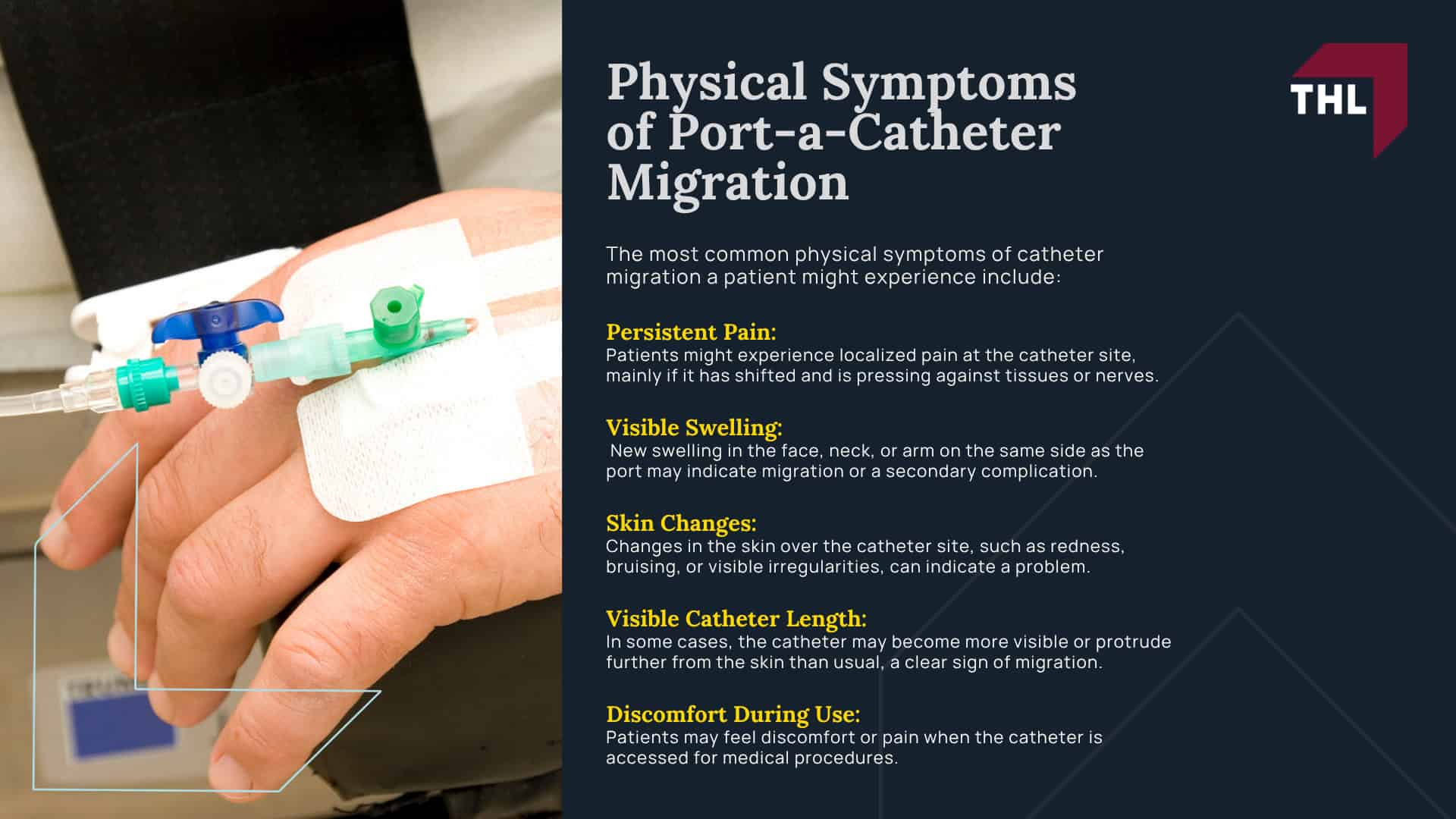 What Is Catheter Migration; The Dangers of Catheter Migration; What Causes Catheter Migration; Physical Symptoms of Port-a-Catheter Migration