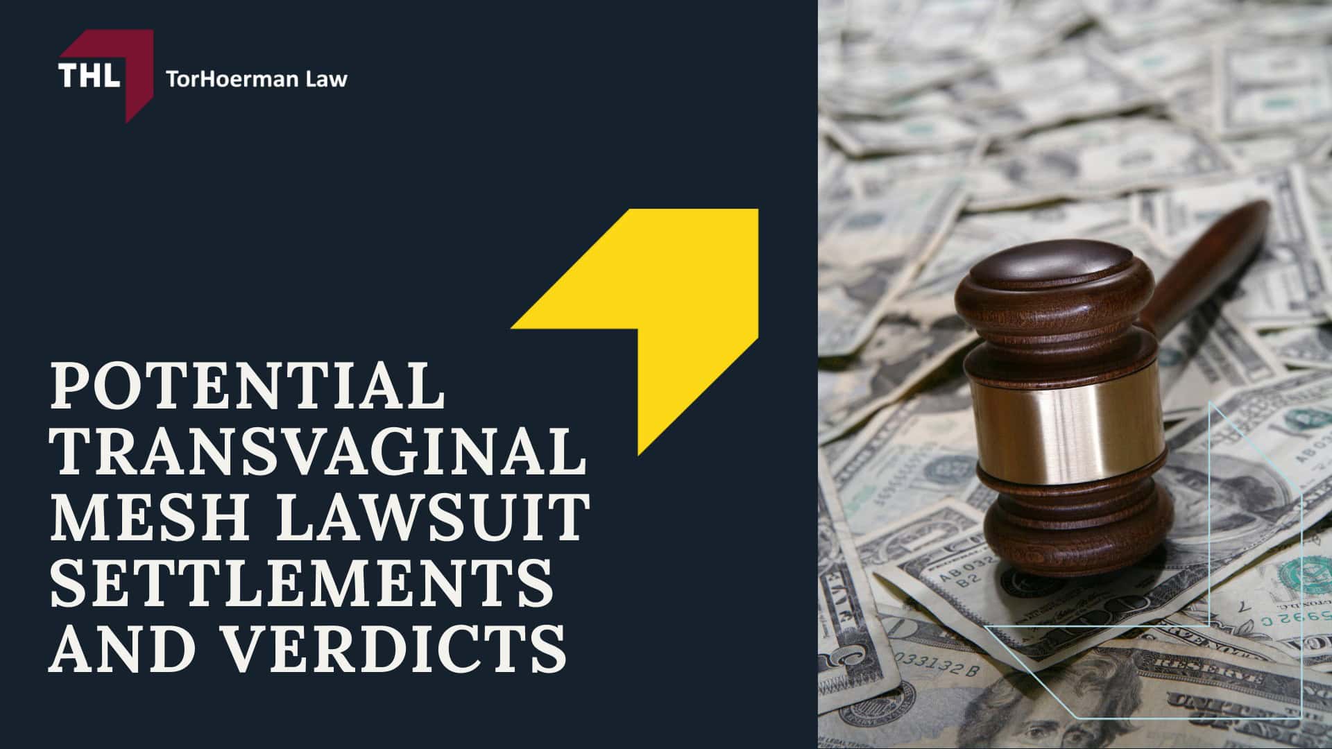 Potential Transvaginal Mesh Lawsuit Settlements and Verdicts; Potential Transvaginal Mesh Lawsuit Settlements and Verdicts; #1 Vaginal Mesh Lawyers for Transvaginal Mesh Injuries - Potential Transvaginal Mesh Lawsuit Settlements and Verdicts; Potential Transvaginal Mesh Lawsuit Settlements and Verdicts; Potential Transvaginal Mesh Lawsuit Settlements and Verdicts; #1 Vaginal Mesh Lawyers for Transvaginal Mesh Injuries - Potential Transvaginal Mesh Lawsuit Settlements and Verdicts