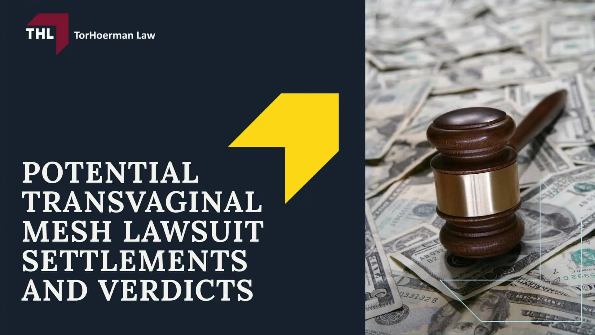 Potential Transvaginal Mesh Lawsuit Settlements and Verdicts; Potential Transvaginal Mesh Lawsuit Settlements and Verdicts; #1 Vaginal Mesh Lawyers for Transvaginal Mesh Injuries - Potential Transvaginal Mesh Lawsuit Settlements and Verdicts; Potential Transvaginal Mesh Lawsuit Settlements and Verdicts; Potential Transvaginal Mesh Lawsuit Settlements and Verdicts; #1 Vaginal Mesh Lawyers for Transvaginal Mesh Injuries - Potential Transvaginal Mesh Lawsuit Settlements and Verdicts