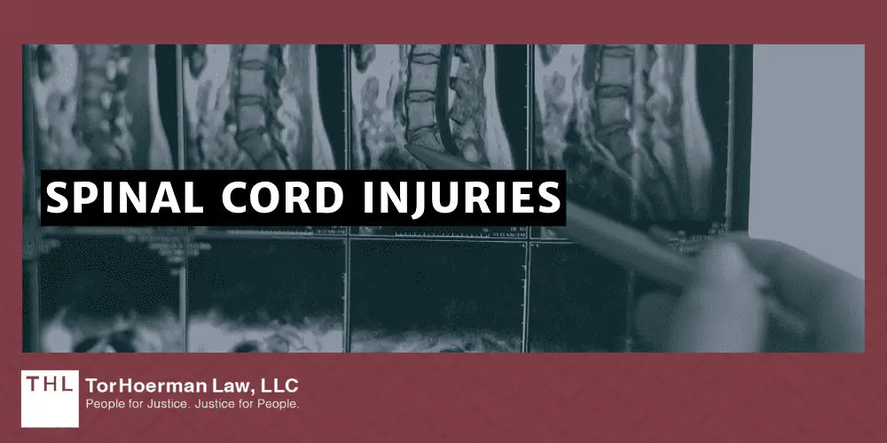 What Are the Most Common Construction Injuries; Most Common Construction Injuries; Construction Accidents; Construction Accident; Construction Injury; Construction Injury Lawyer; Construction Accident Lawsuit; Most Common Accidents On Construction Sites_ An Overview; Falls From Heights; Injuries From Machinery And Equipment; Electrocutions And Electrical Shocks; Being Struck By Falling Objects; Overexertion Injuries; Repetitive Stress Injuries; Caught-In_Between Injuries; Traumatic Brain Injuries; Broken Bones; Slips And Trips; Spinal Cord Injuries