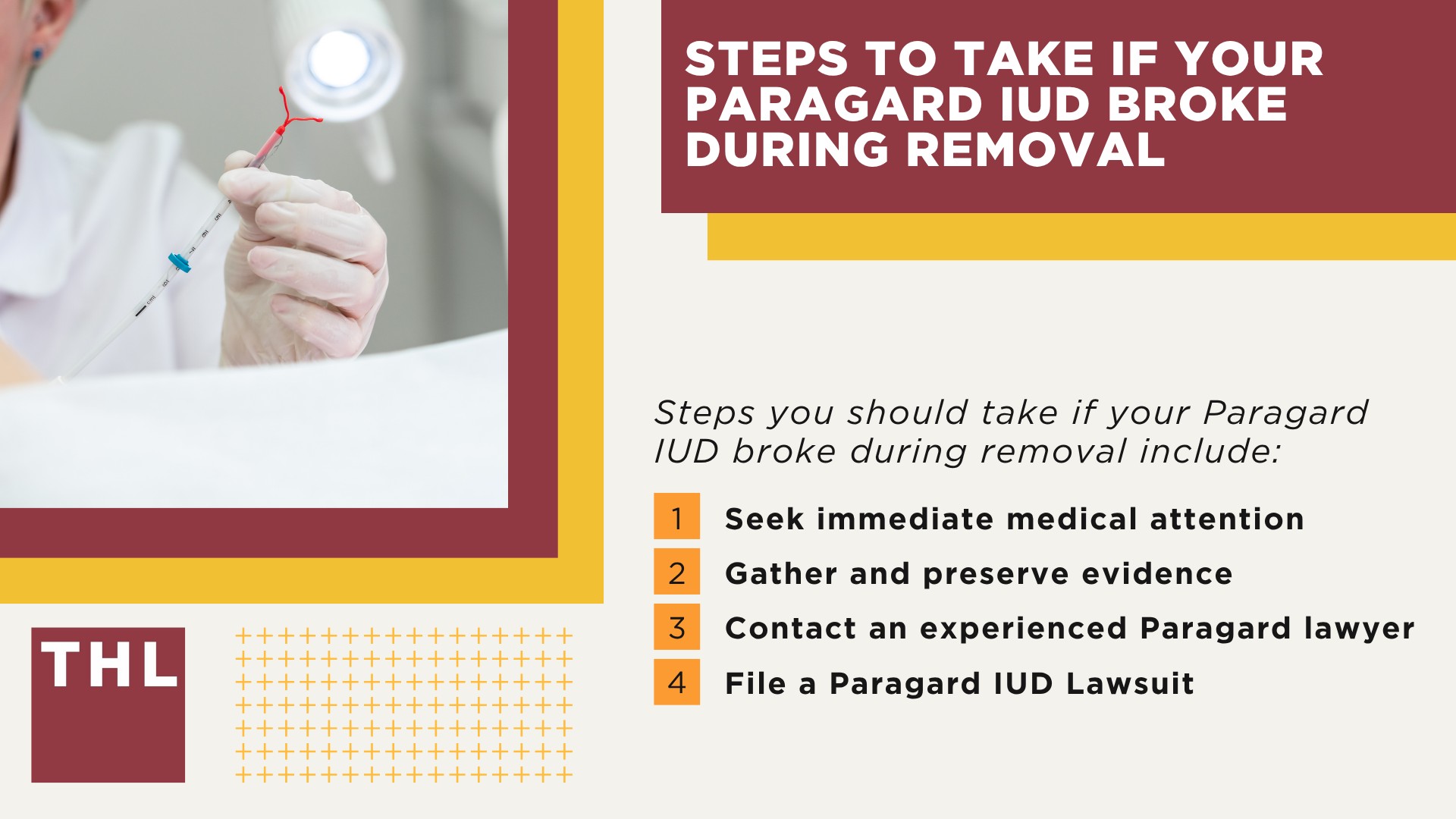 Potential for Paragard IUD Breakage During Removal; What is the Paragard Copper IUD; Paragard Lawsuit Overview; Steps To Take if Your Paragard IUD Broke During Removal