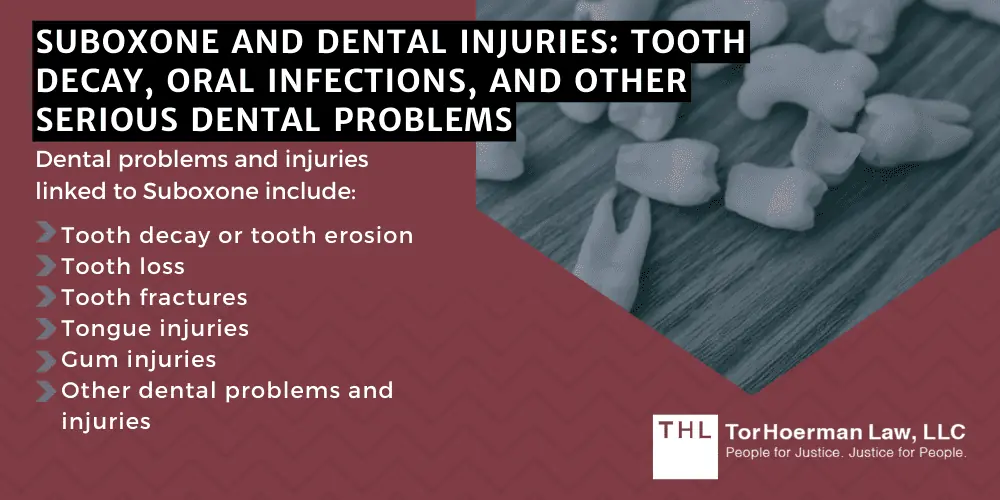 Suboxone Lawsuit; Suboxone Tooth Decay Lawsuits; Suboxone Tooth Decay Lawsuit; Suboxone Lawyers; Suboxone Teeth Decay; Suboxone Class Action Lawsuit; Suboxone Lawsuit Overview & Developments; Suboxone And Dental Injuries_ Tooth Decay, Oral Infections, And Other Serious Dental Problems