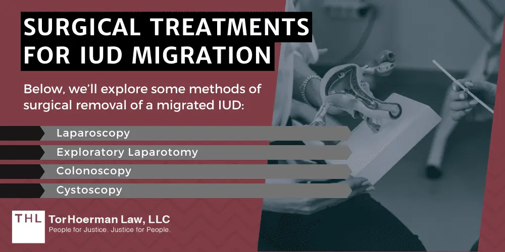 Surgical Treatment for IUD Migration; Paragard Lawsuit; Paragard IUD Lawsuit; Paragard Lawsuits; Paragard Lawyers; Paragard Migration; Paragard Fracture; Paragard MDL; What Is The Paragard IUD; Understanding IUD Migration; What Does IUD Migration Mean; What Are The Complications Of IUD Migration; What Factors Cause An IUD To Migrate; Signs of IUD Migration; Surgical Treatments For IUD Migration