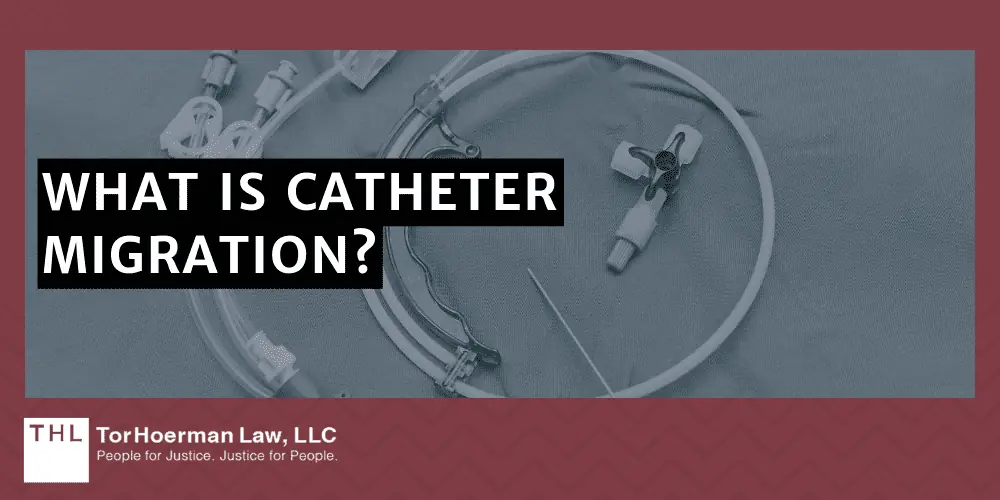 Port a Catheter Migration Symptoms; Bard PowerPort Lawsuit; Bard PowerPort Lawsuits; Port Catheter Lawsuit; What Is Catheter Migration