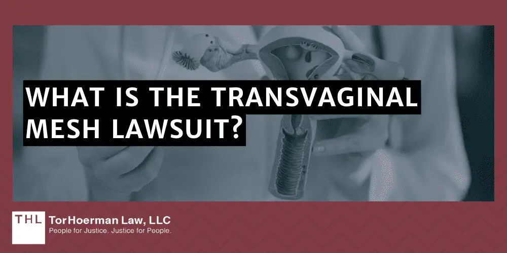 #1 Transvaginal Mesh Lawyers for Transvaginal Mesh Injuries; Transvaginal Mesh Injuries; Vaginal Mesh Lawsuit; Transvaginal Mesh Lawsuits; Transvaginal Mesh Lawyers; #1 Transvaginal Mesh Lawyers for Transvaginal Mesh Injuries; Transvaginal Mesh Injuries; Vaginal Mesh Lawsuit; Transvaginal Mesh Lawsuits; Transvaginal Mesh Lawyers; #1 Transvaginal Mesh Lawyers for Transvaginal Mesh Injuries; Transvaginal Mesh Injuries; Vaginal Mesh Lawsuit; Transvaginal Mesh Lawsuits; Transvaginal Mesh Lawyers; Injuries Associated With Transvaginal Mesh Implants; What Is The Transvaginal Mesh Lawsuit