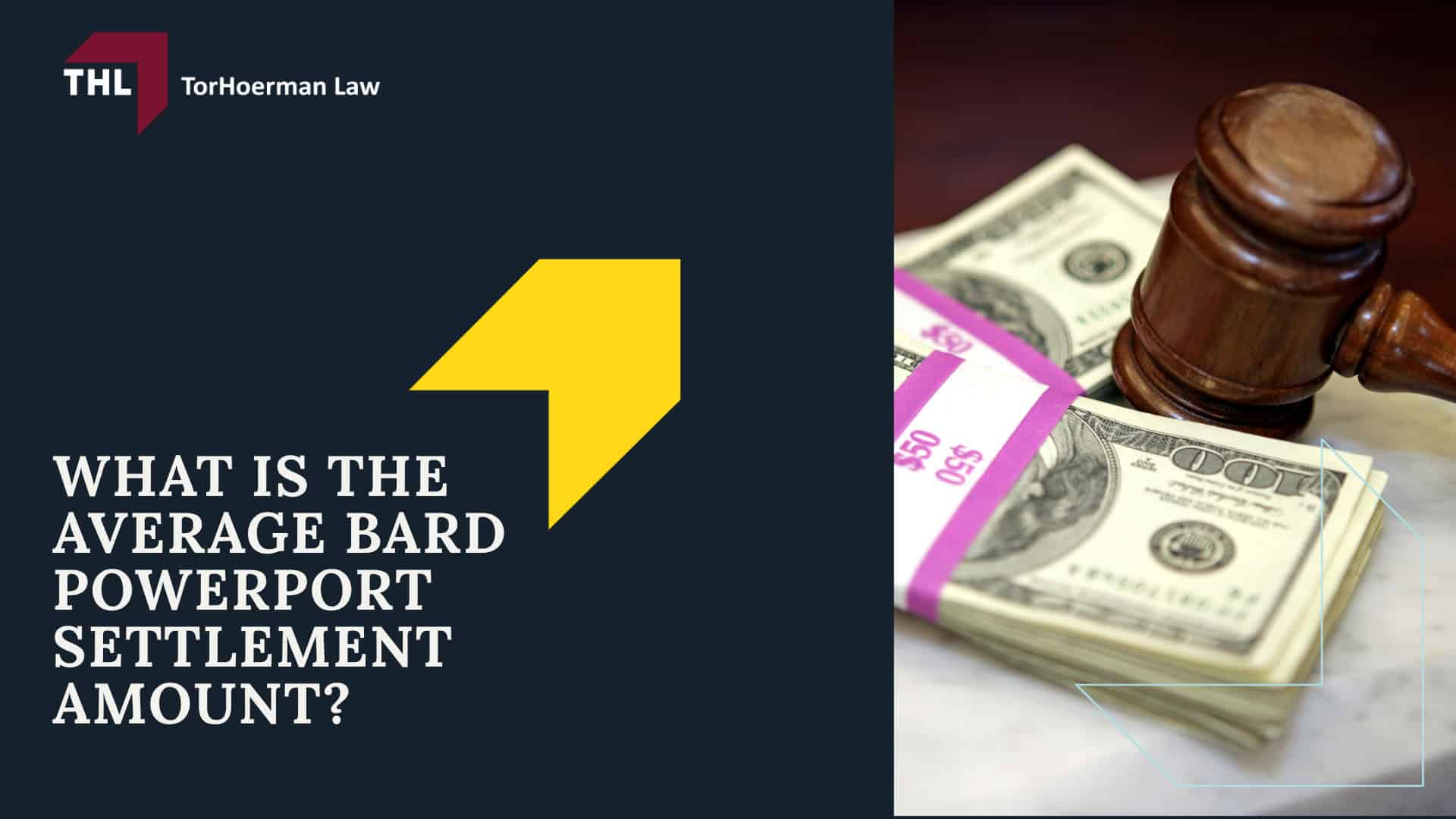 Bard PowerPort Lawsuits for Complications and Injuries; Bard PowerPort Complications and Injuries; PowerPort Complications_ Symptoms To Watch For; What Is the Bard PowerPort Lawsuit; Elements of the Bard PowerPort Lawsuit; What is the Bard PowerPort Multidistrict Litigation (MDL); What is the Average Bard PowerPort Settlement Amount; What is the Average Bard PowerPort Settlement Amount