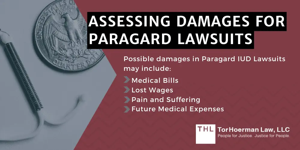 Assessing Damages For Paragard Lawsuits