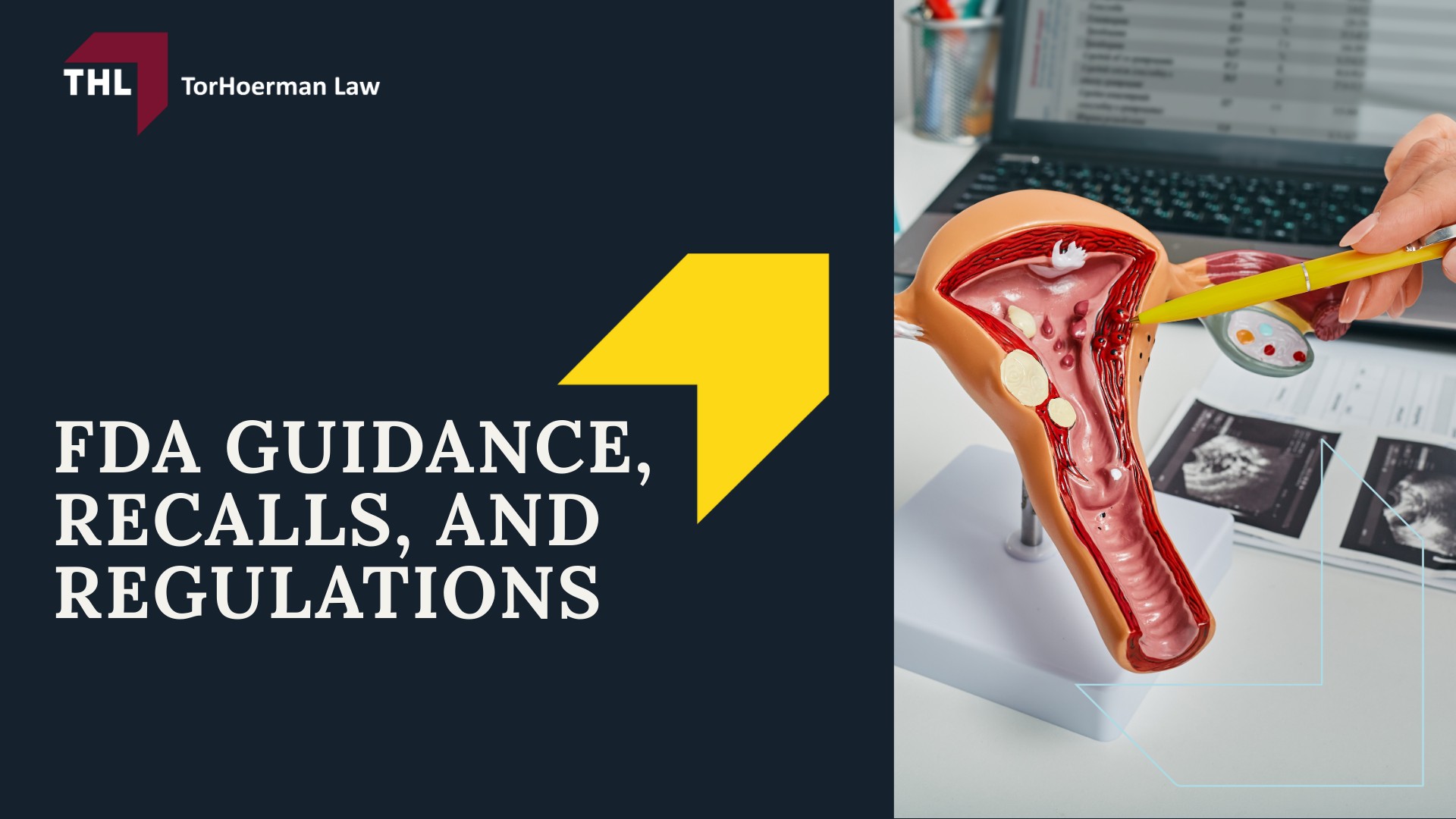 Bard Vaginal Mesh Lawsuit - Bard Vaginal Mesh_ An Overview - torhoerman law; Bard Vaginal Mesh Lawsuit - Bard Vaginal Mesh Lawsuits_ Reasons Behind the Litigation - torhoerman law; Bard Vaginal Mesh Lawsuit - Settlements for Bard Vaginal Mesh Lawsuits - torhoerman law; Bard Vaginal Mesh Lawsuit - Current Status of Ongoing Litigation - torhoerman law; Bard Vaginal Mesh Lawsuit - Comparing Bard With Other Vaginal Mesh Products - torhoerman law; Bard Vaginal Mesh Lawsuit - FDA Guidance, Recalls, and Regulations - torhoerman law