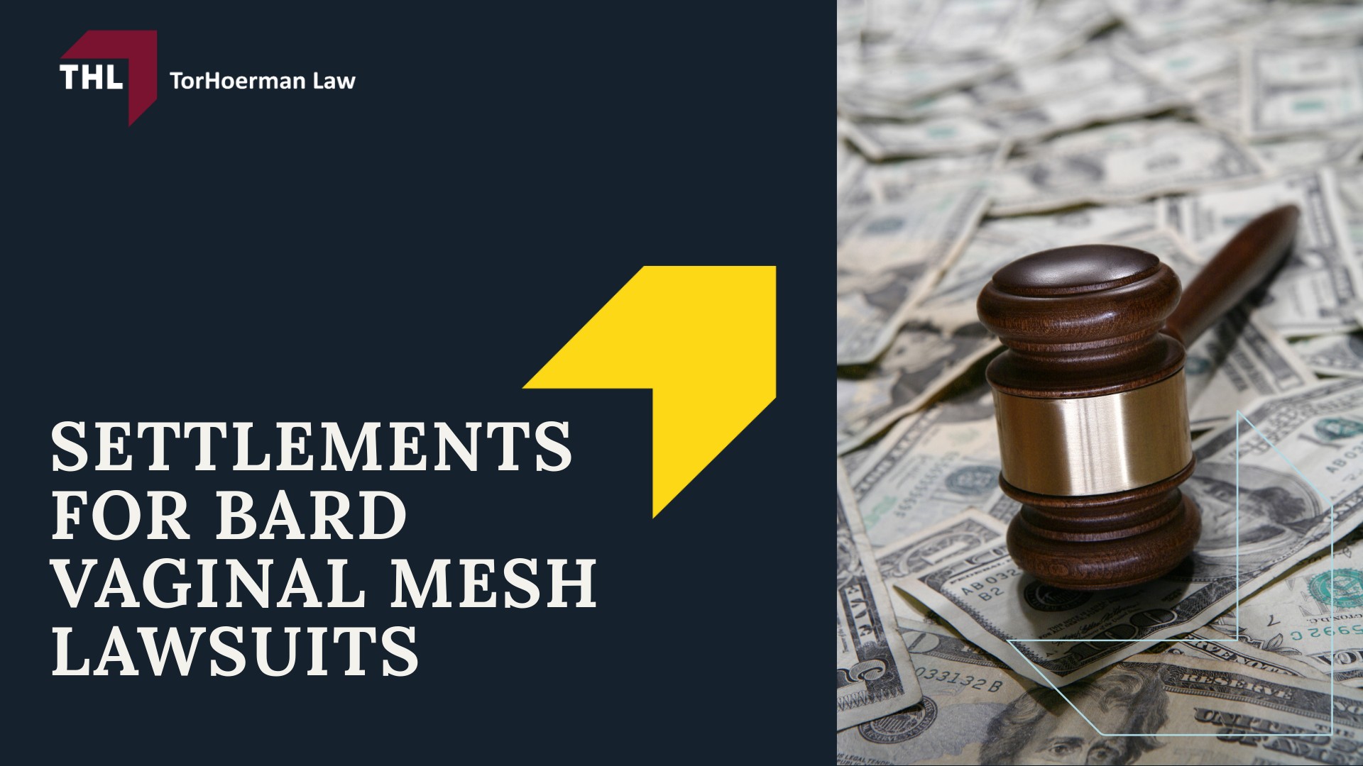 Bard Vaginal Mesh Lawsuit - Bard Vaginal Mesh_ An Overview - torhoerman law; Bard Vaginal Mesh Lawsuit - Bard Vaginal Mesh Lawsuits_ Reasons Behind the Litigation - torhoerman law; Bard Vaginal Mesh Lawsuit - Settlements for Bard Vaginal Mesh Lawsuits - torhoerman law
