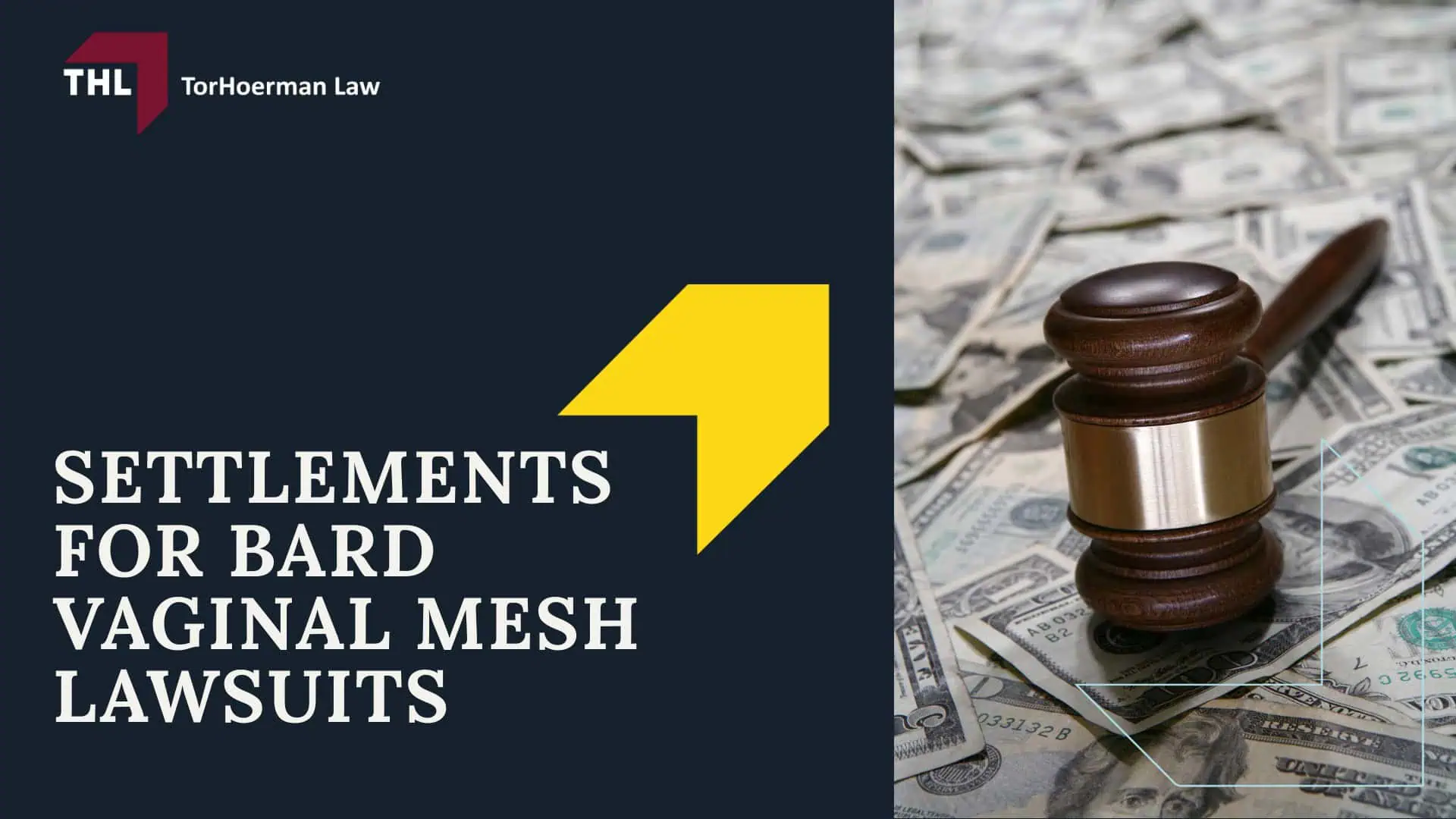 Bard Vaginal Mesh Lawsuit - Bard Vaginal Mesh_ An Overview - torhoerman law; Bard Vaginal Mesh Lawsuit - Bard Vaginal Mesh Lawsuits_ Reasons Behind the Litigation - torhoerman law; Bard Vaginal Mesh Lawsuit - Settlements for Bard Vaginal Mesh Lawsuits - torhoerman law