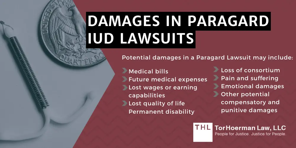 Damages In Paragard IUD Lawsuits