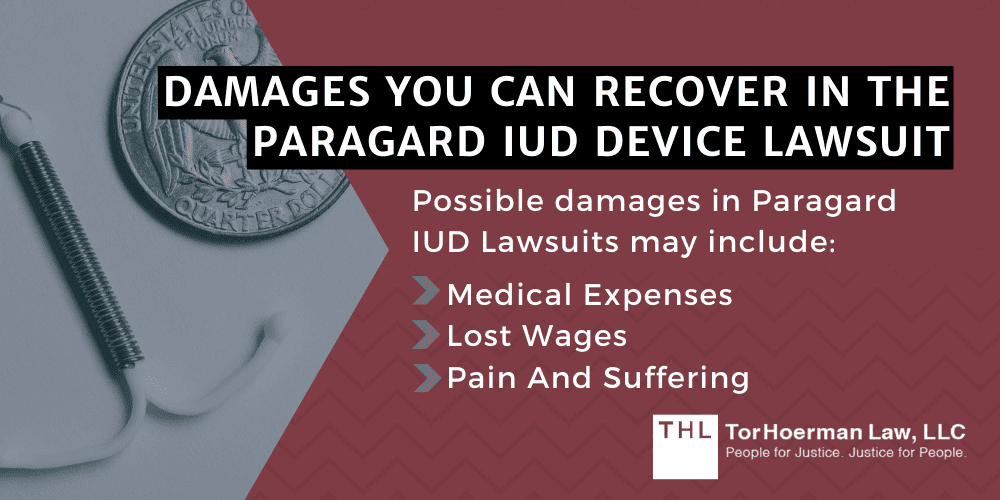 Paragard Attorney; Paragard Lawyer; Paragard Lawyers; Paragard Lawsuit; Paragard Lawsuits; Paragard IUD Lawsuit; The Benefits Of Hiring An Experienced Paragard Lawyers; What You Need To Know About The Paragard Lawsuit; Risks And Injuries Associated With The Paragard IUD; Damages You Can Recover In The Paragard IUD Device Lawsuit