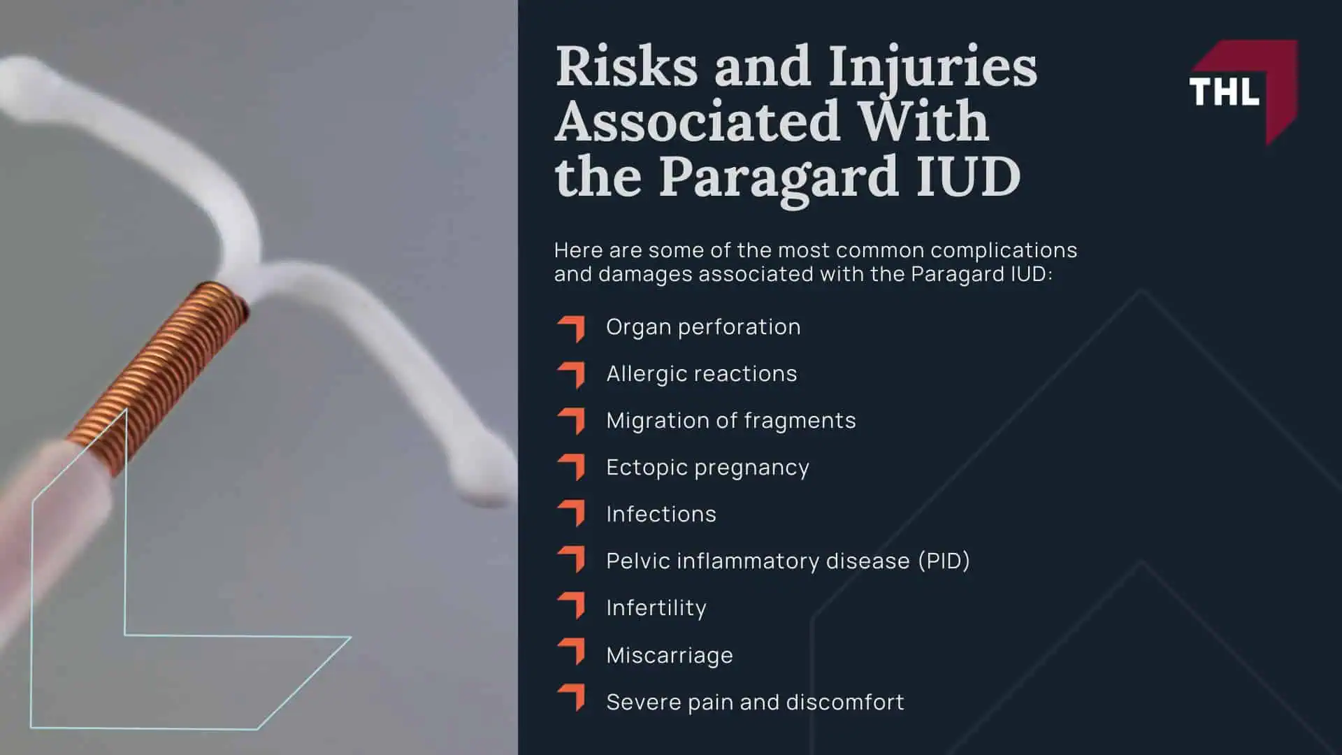 The Benefits of Hiring an Experienced Paragard Lawyer; FAQ What Are the Benefits of Hiring a Paragard Attorney - What You Need To Know About the Paragard Lawsuit - torhoerman law; FAQ What Are the Benefits of Hiring a Paragard Attorney - Overview of the Paragard IUD Lawsuit - torhoerman law (1); What You Need To Know About the Paragard Lawsuit
