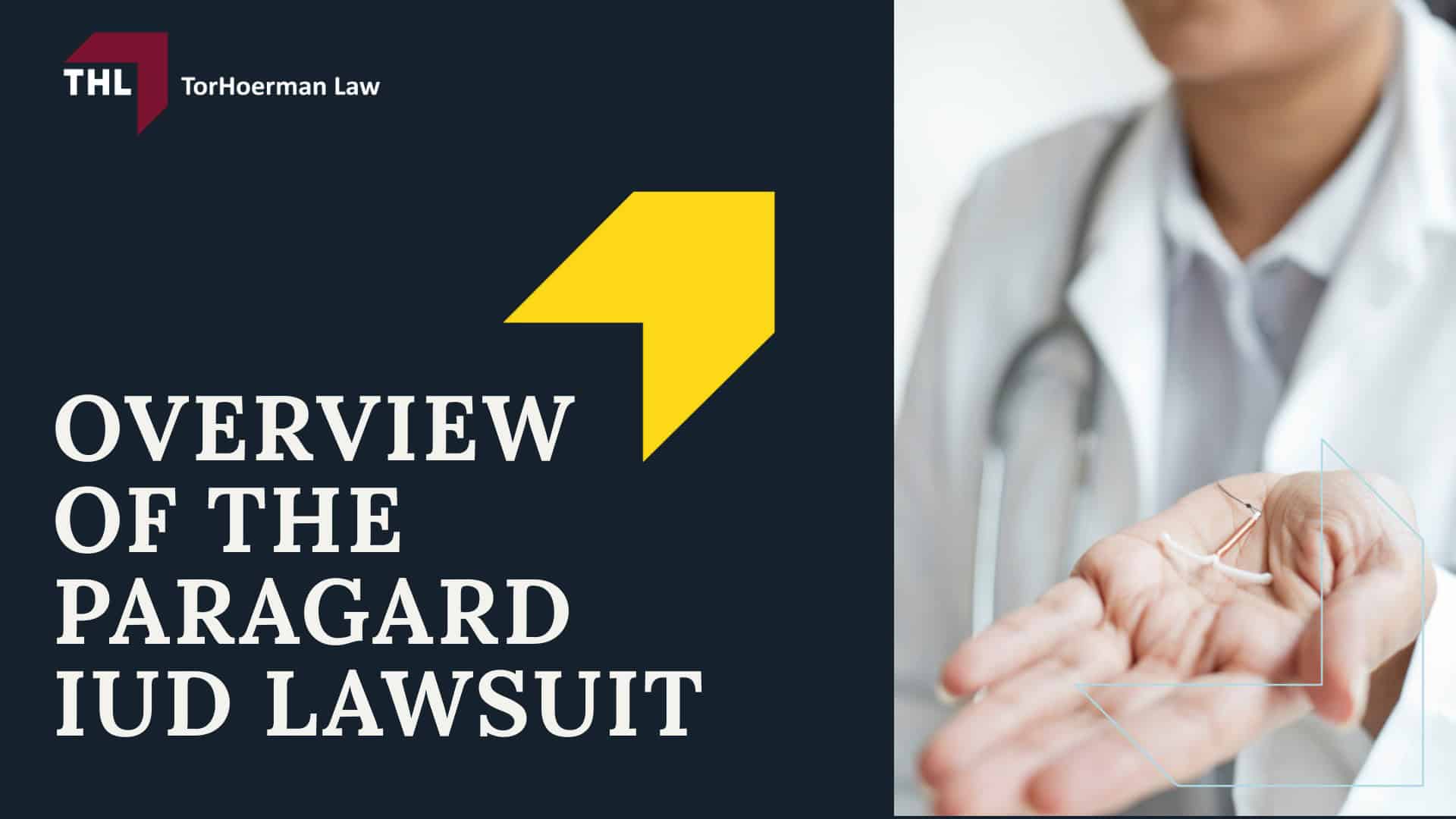 The Benefits of Hiring an Experienced Paragard Lawyer; FAQ What Are the Benefits of Hiring a Paragard Attorney - What You Need To Know About the Paragard Lawsuit - torhoerman law; FAQ What Are the Benefits of Hiring a Paragard Attorney - Overview of the Paragard IUD Lawsuit - torhoerman law (1)