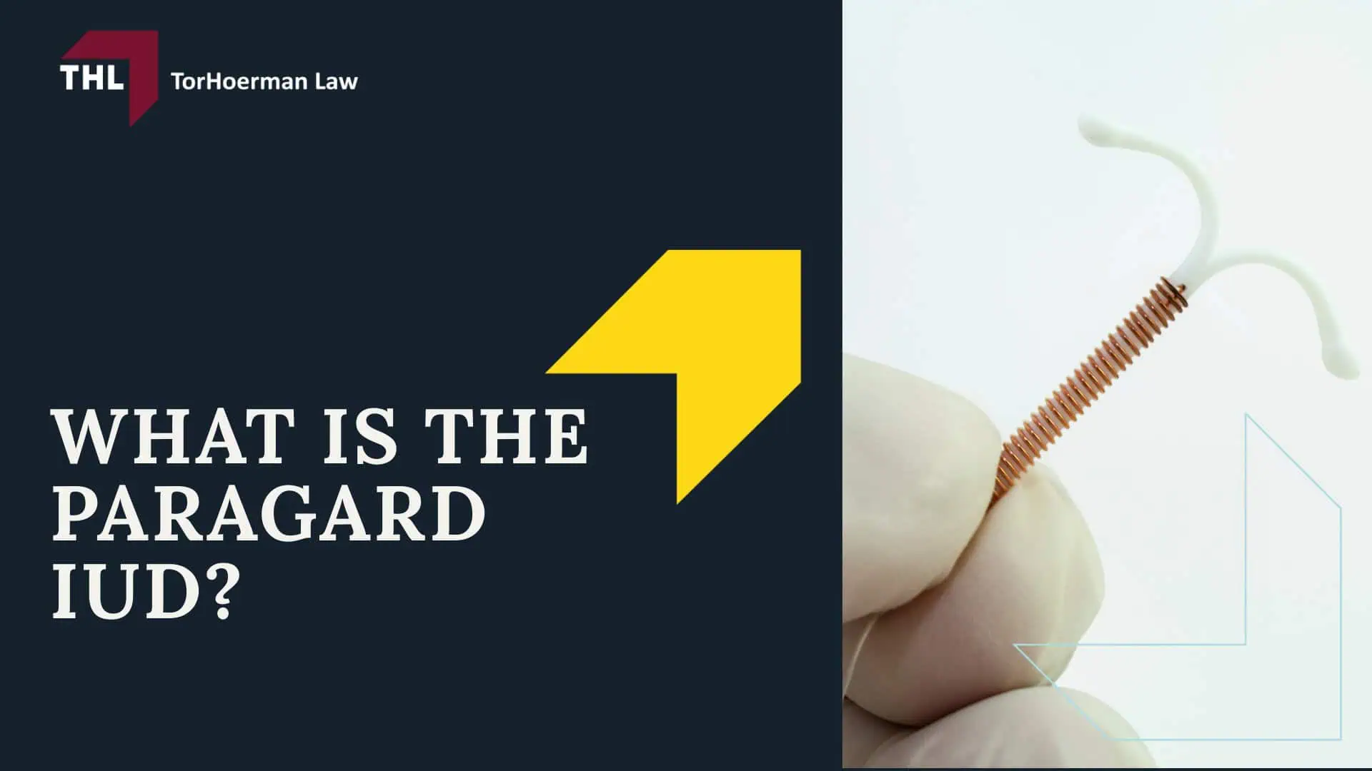 FAQ What Are the Long-Term Effects of Paragard IUD Injury - What Is the Paragard IUD - torhoerman law