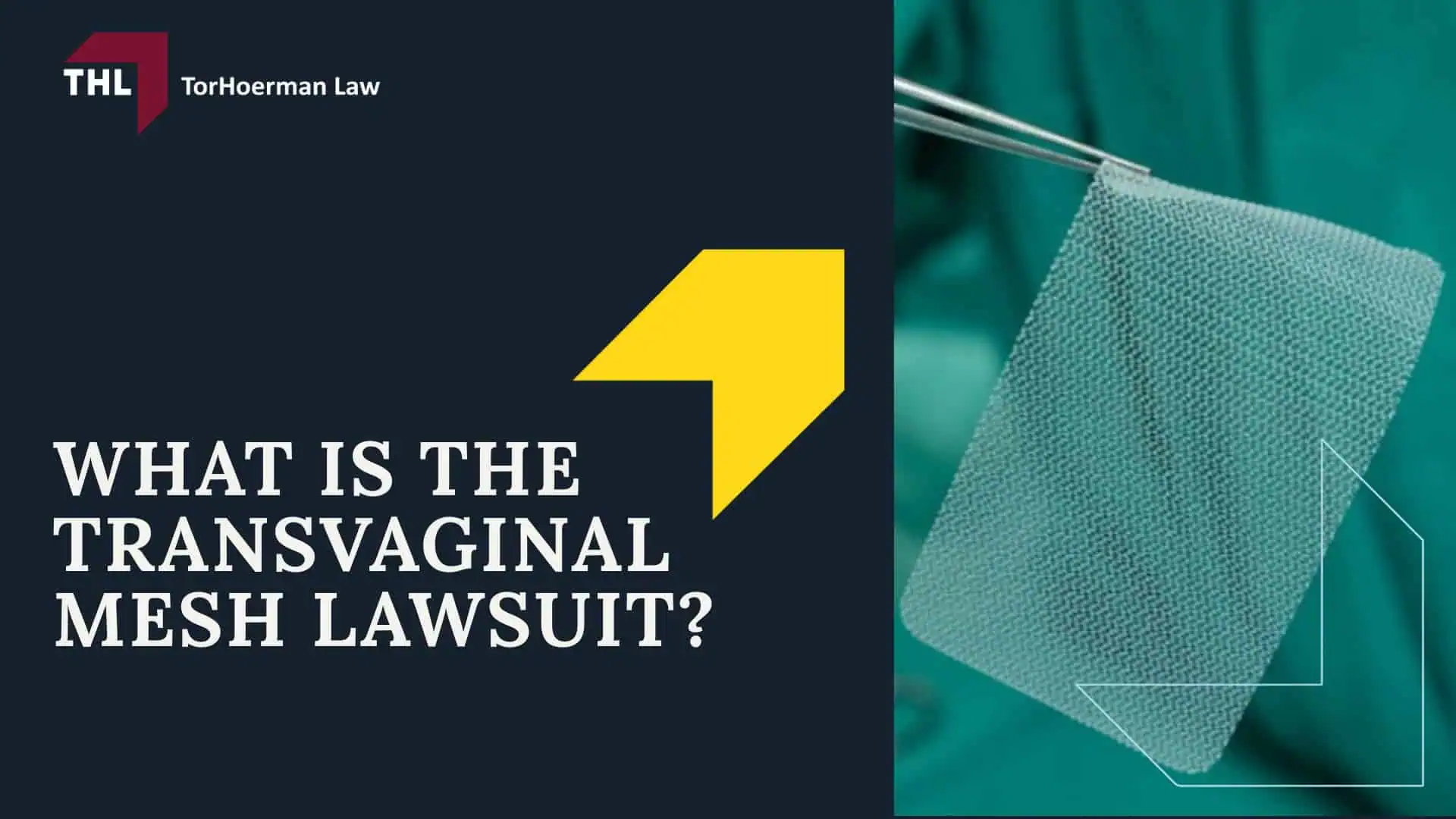 FAQ_ Do I Qualify for the Transvaginal Mesh Lawsuit_ - What Is the Transvaginal Mesh Lawsuit_ - torhoerman law