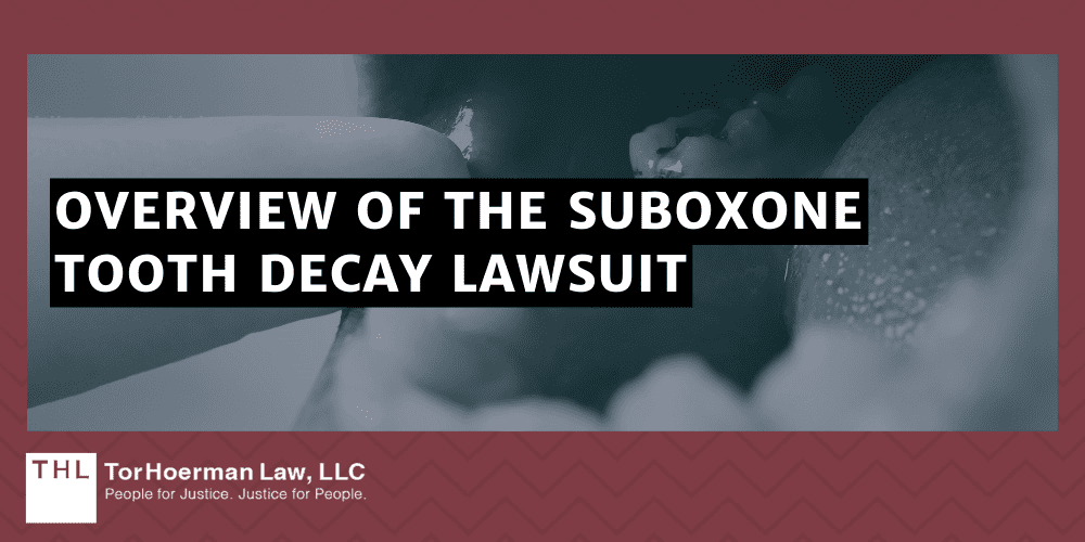Does Suboxone Cause Tooth Decay; Suboxone Tooth Decay Lawsuits; Suboxone Tooth Decay Lawsuit; Suboxone Lawsuit; Understanding The Link Between Suboxone And Dental Problems; Dental Injuries Linked To Suboxone; Overview Of The Suboxone Tooth Decay Lawsuit