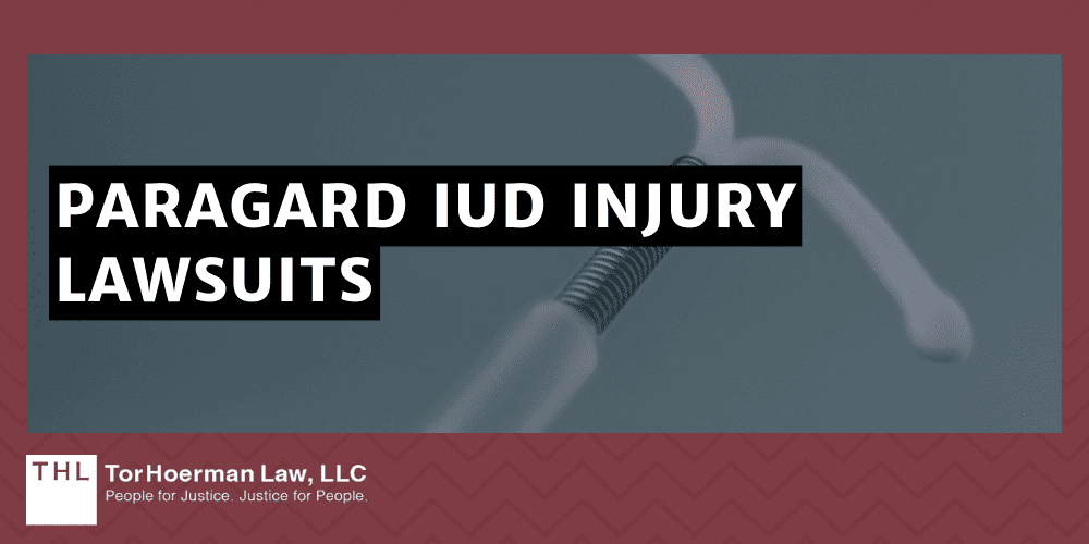 Paragard IUD Removal Complications; Paragard Lawsuit; Paragard IUD Lawsuit; Paragard IUD Lawsuits; Paragard Lawyers; Paragard Attorneys; What Is An Intrauterine Device (IUD); The IUD Removal Process; Potential IUD Removal Complications And Health Effects; Paragard IUD Injury Lawsuits