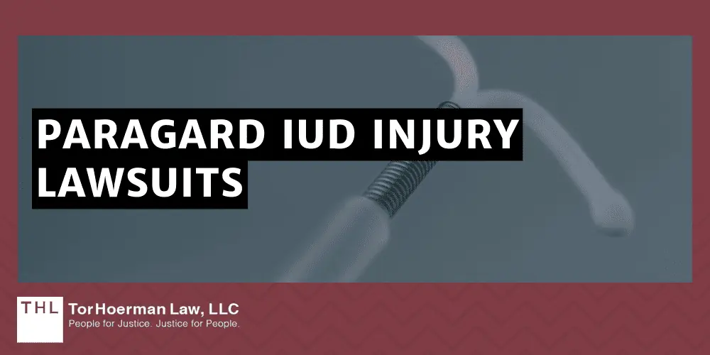 Paragard IUD Injury Lawsuits
