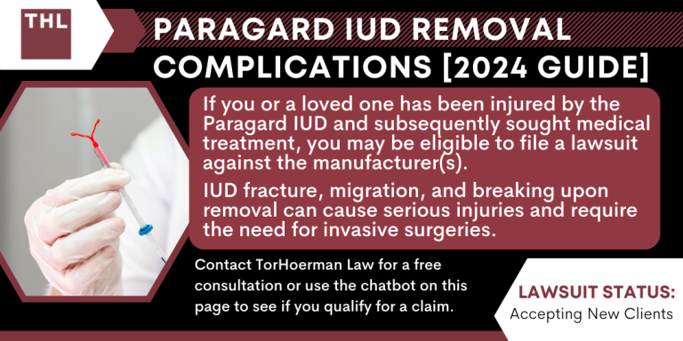 Paragard IUD Removal Complications; Paragard Lawsuit; Paragard IUD Lawsuit; Paragard IUD Lawsuits; Paragard Lawyers; Paragard Attorneys; What Is An Intrauterine Device (IUD); The IUD Removal Process; Potential IUD Removal Complications And Health Effects; Paragard IUD Injury Lawsuits; Do You Qualify To File A Paragard Lawsuit; Gathering Evidence For Paragard IUD Lawsuits; Damages In Paragard IUD Lawsuits