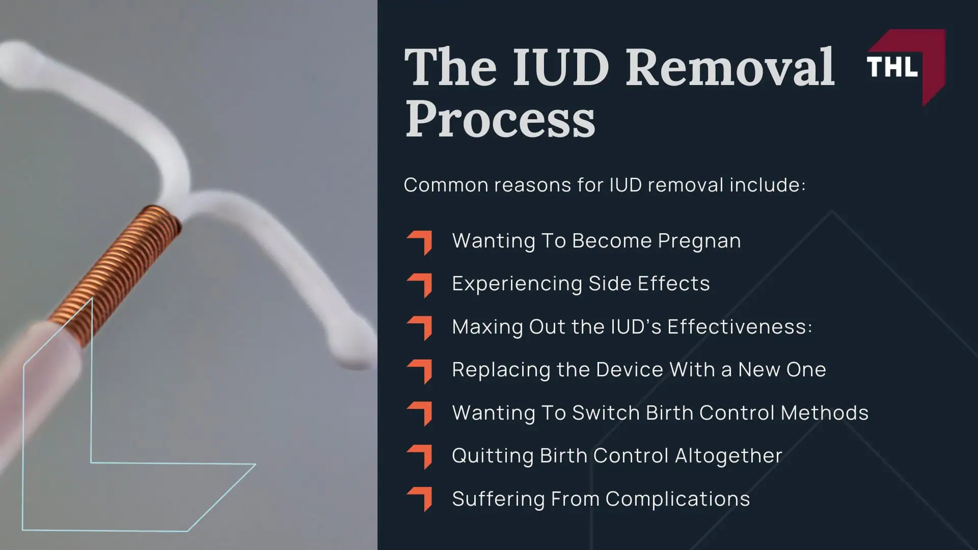 Paragard IUD Removal Complications - What Is an Intrauterine Device (IUD) - torhoerman law; Paragard IUD Removal Complications - The IUD Removal Process - torhoerman law