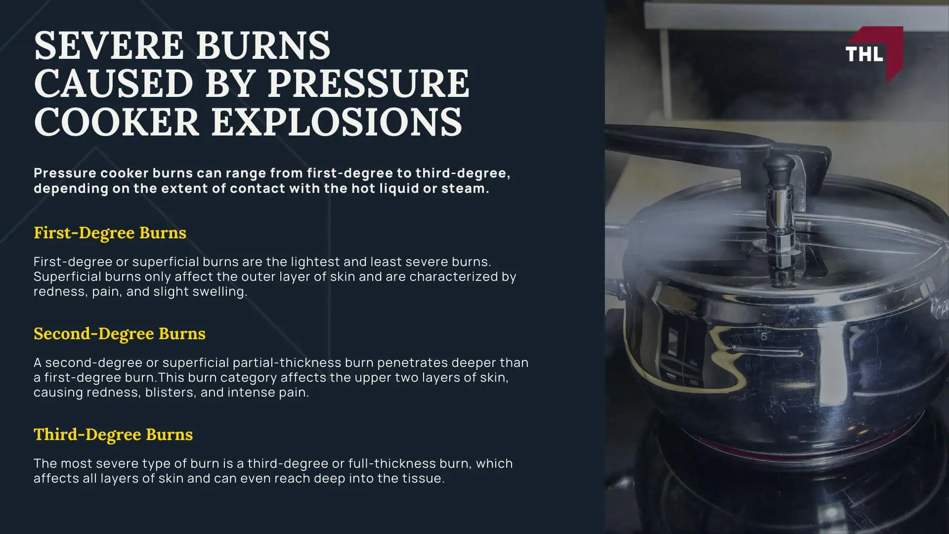 Pressure Cooker Burn Lawsuit - Severe Burns Caused by Pressure Cooker Explosions - torhoerman law; Pressure Cooker Burn Lawsuit - Severe Burns Caused by Pressure Cooker Explosions - torhoerman law