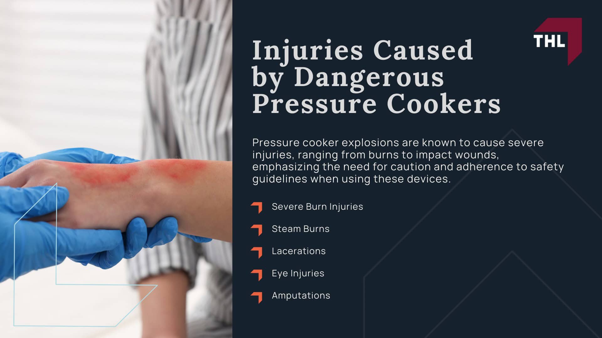 Pressure Cooker Injuries - Injuries Caused by Dangerous Pressure Cookers - torhoerman law