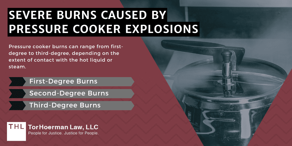 Pressure Cooker Burn Lawsuit; Pressure Cooker Burns; Pressure Cooker Injuries; Pressure Cooker Lawsuit; Pressure Cooker Explosion Lawsuit; Severe Burns Caused By Pressure Cooker Explosions