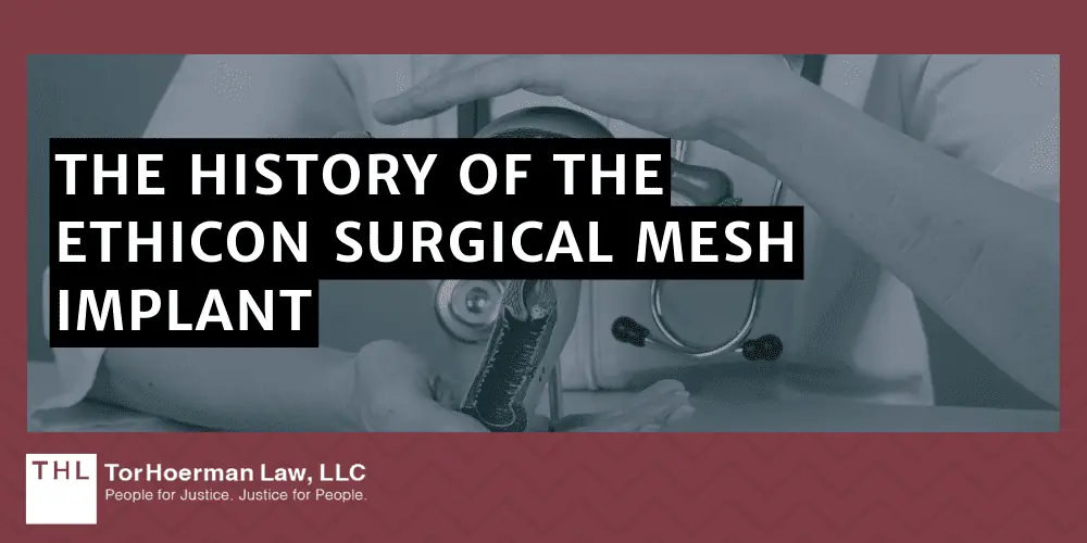 Ethicon Transvaginal Mesh Lawsuit; Transvaginal Mesh Lawsuits; Vaginal Mesh Lawsuit; Transvaginal Mesh Lawyers; Ethicon Transvaginal Mesh Lawsuit; Transvaginal Mesh Lawsuits; Vaginal Mesh Lawsuit; Transvaginal Mesh Lawyers; What Is The Ethicon Pelvic Mesh Implant; What Are The Risks And Complications Associated With Surgical Mesh Devices; The History Of The Ethicon Surgical Mesh Implant
