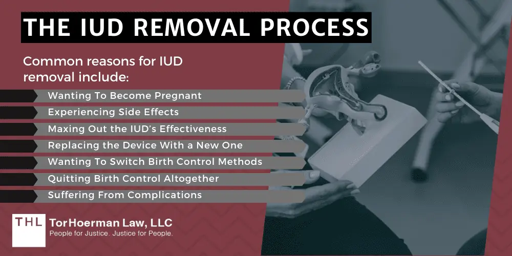 The IUD Removal Process