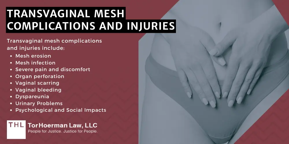 Boston Scientific Vaginal Mesh Lawsuit; Transvaginal Mesh Lawsuits; Vaginal Mesh Lawsuits; Boston Scientific And Vaginal Mesh Implants; Transvaginal Mesh Complications And Injuries